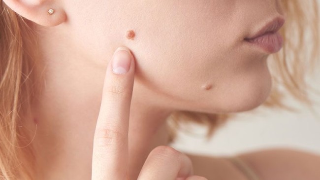 Eczanede Satılan Et Beni İlacı