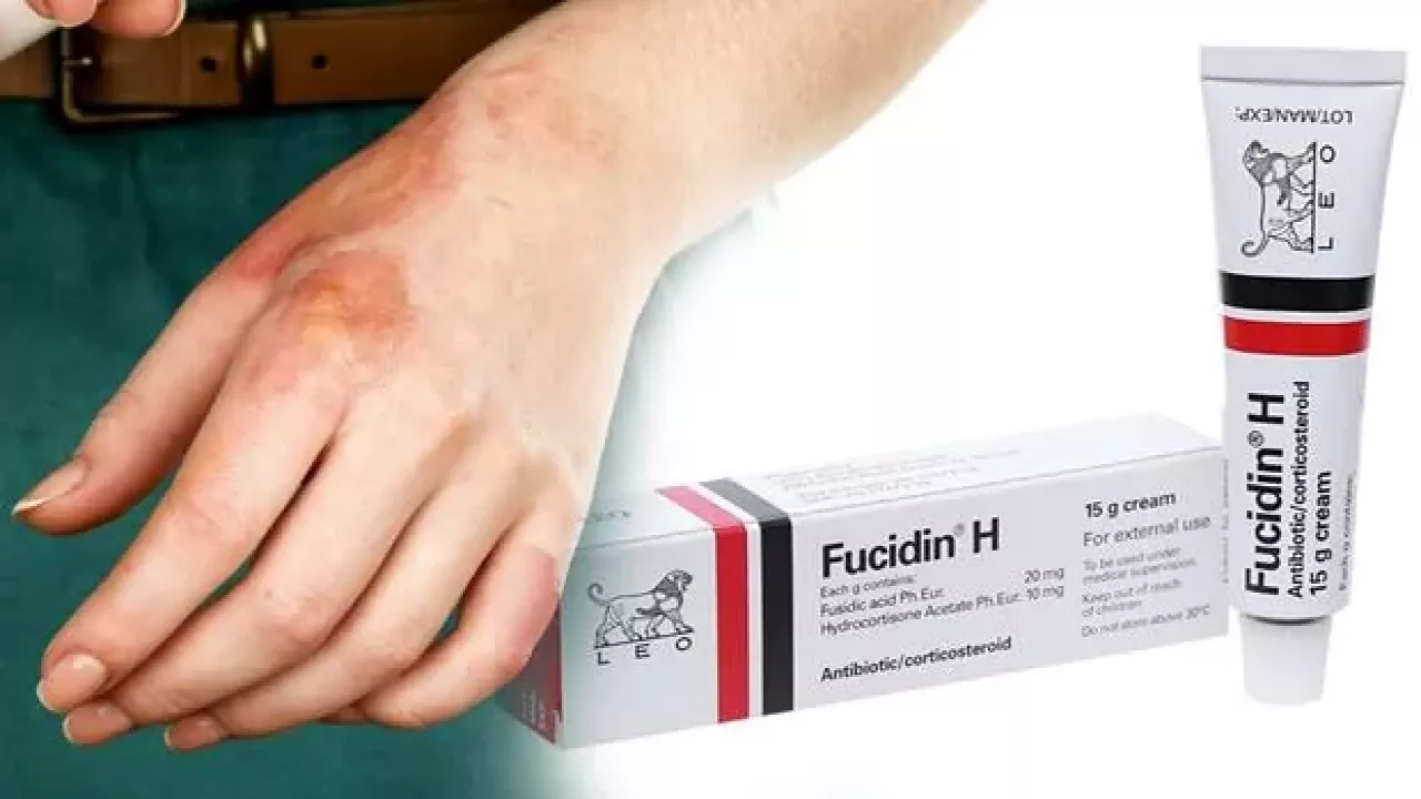 En Iyi Iltihap Kurutucu Antibiyotik Krem 1
